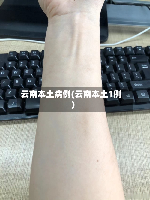 云南本土病例(云南本土1例)